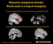 ocd-brain-loop-neurosciencenews.jpg