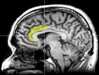 MRI_anterior_cingulate.png